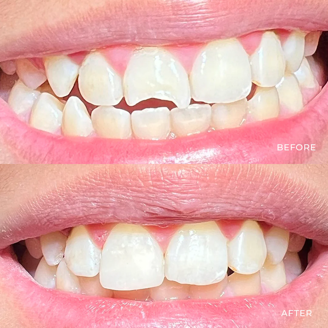 Digital Smile Design