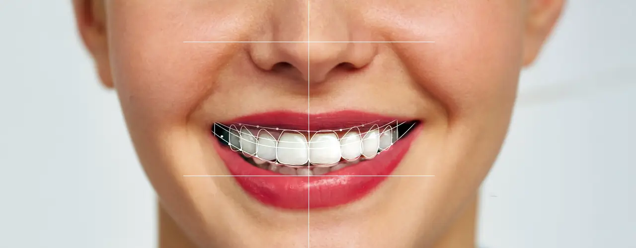 Digital Smile Design